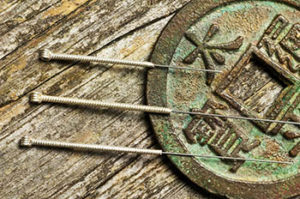Three acupuncture needles laid across an antique asian coin.